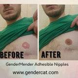 GenderMender Prosthetic Nipples for Men and Women in over 100 skin-tones-GenderCat
